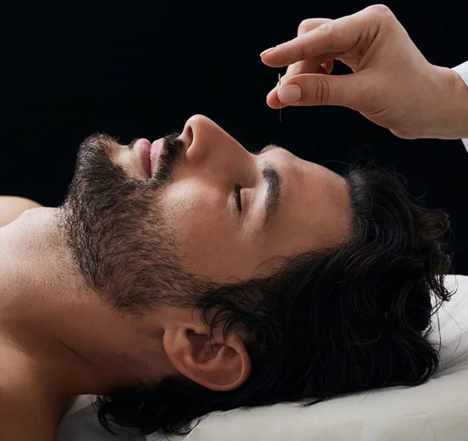 acupuncteur-aiguille-visage-homme Séance acupuncture